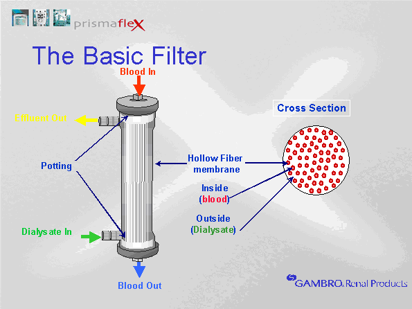 Basic filter diagram