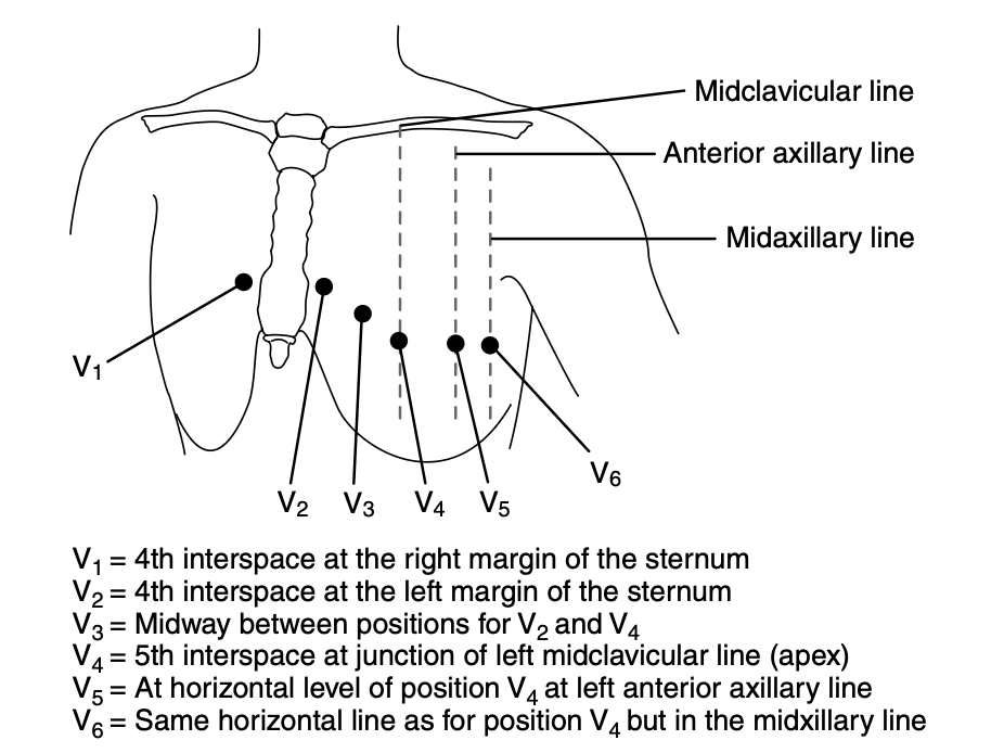 Chest lead sites against the midclavicular, anterior axillary and midaxillary lines; interspace positions in the legend