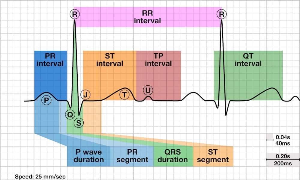 ECG waveforms showing intervals for rate calculation