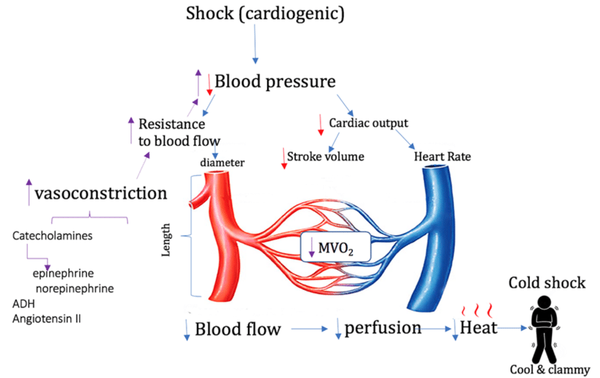 Cardiogenic shock cycle: falling blood pressure and cardiac output, vasoconstriction, low blood flow and cool, clammy skin
