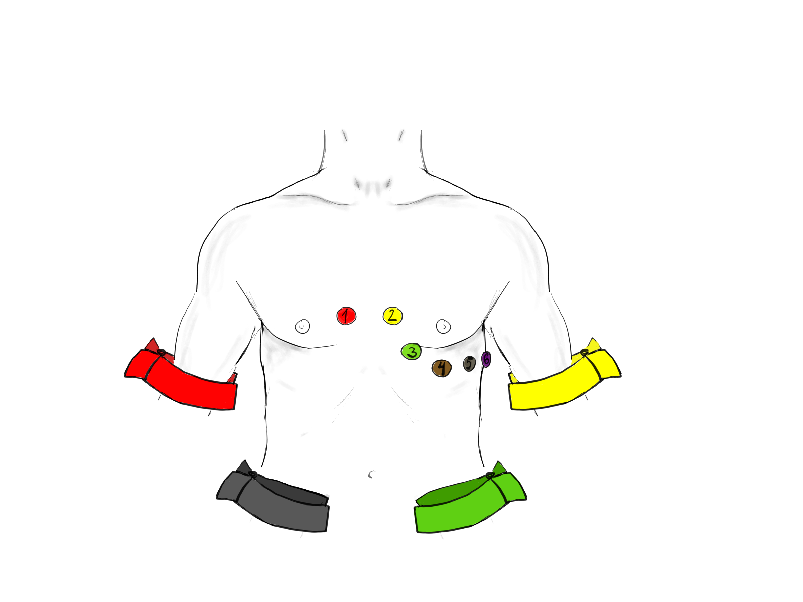 Standard 12-lead layout: four limb electrodes and six chest electrodes, V1 to V6