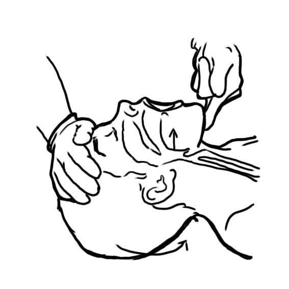 Head-tilt chin-lift: one hand on the forehead tilts the head back while the fingertips lift the chin