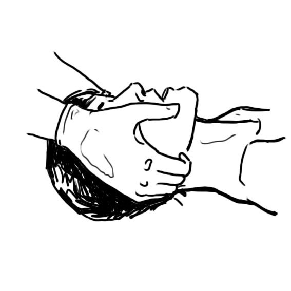 Jaw thrust: fingers behind the angles of the lower jaw lift it forward while the head stays in line