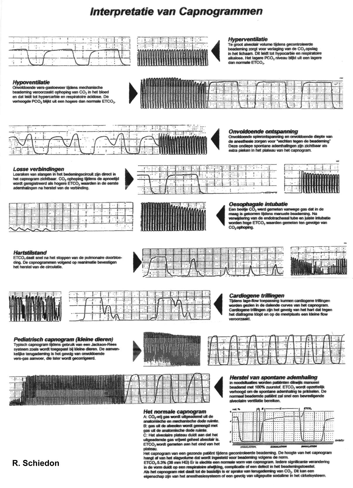 Capnogram patterns: hypo- and hyperventilation, curare cleft, loose connection, esophageal tube, cardiac arrest
