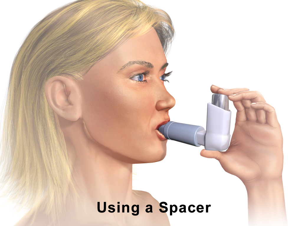 Adult using a metered-dose inhaler with a spacer, inhaling from the mouthpiece