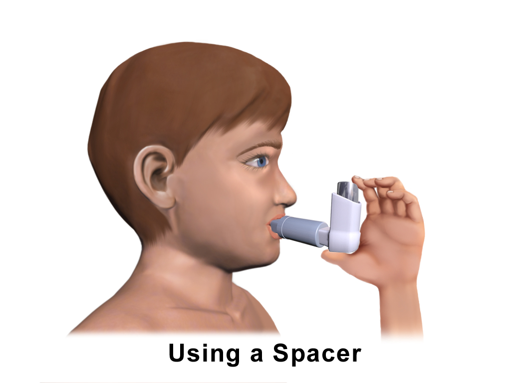 Child using a metered-dose inhaler with a spacer mouthpiece, inhaling from the device