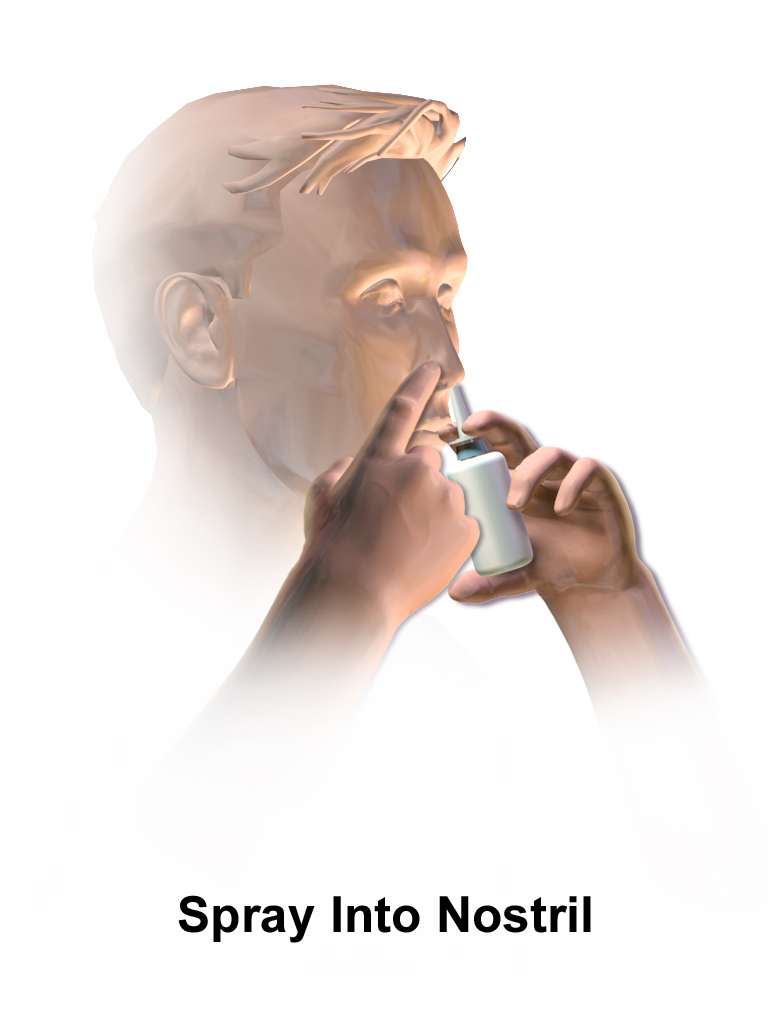 Illustration of a nasal spray tip inserted into one nostril during administration