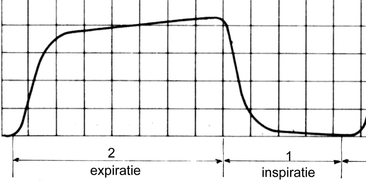 One normal capnogram breath with baseline (inspiration) and expiration phases; EtCO₂ is read at the end of the plateau