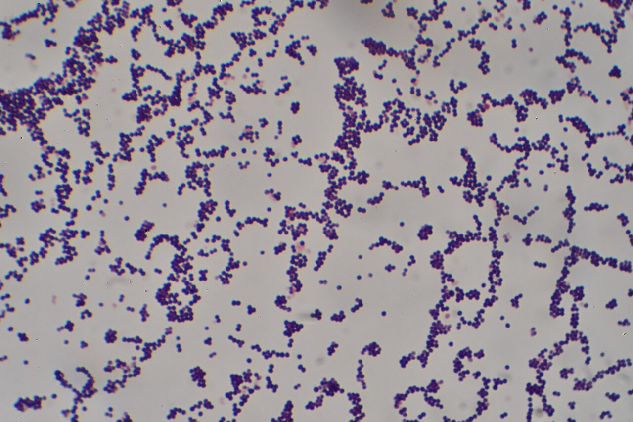 Reference Gram stain of Staphylococcus aureus, not a patient culture, showing purple gram-positive cocci in clusters and short chains