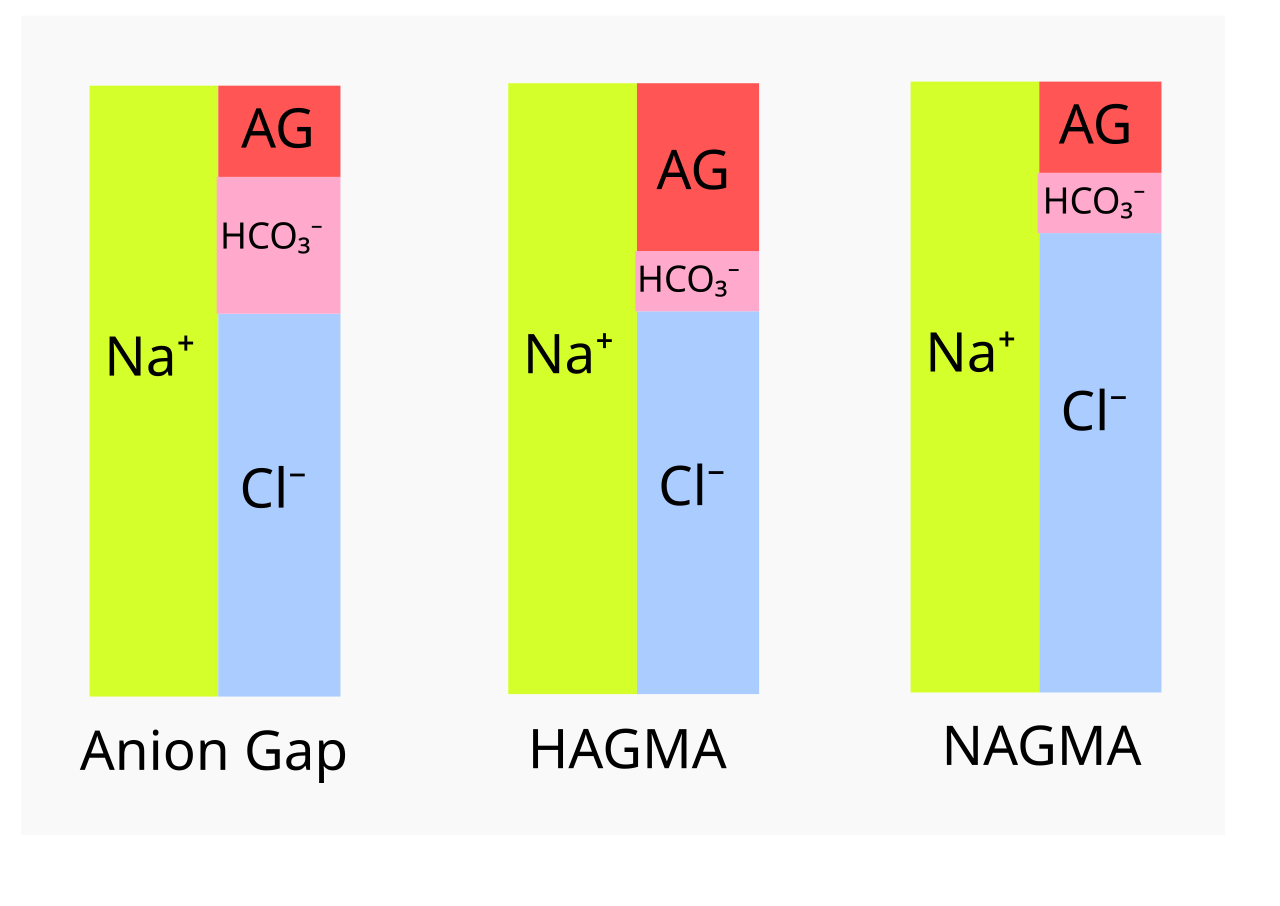 Gamblegram: normal anion gap, high-gap acidosis with a wider gap, and normal-gap acidosis with chloride replacing HCO₃⁻