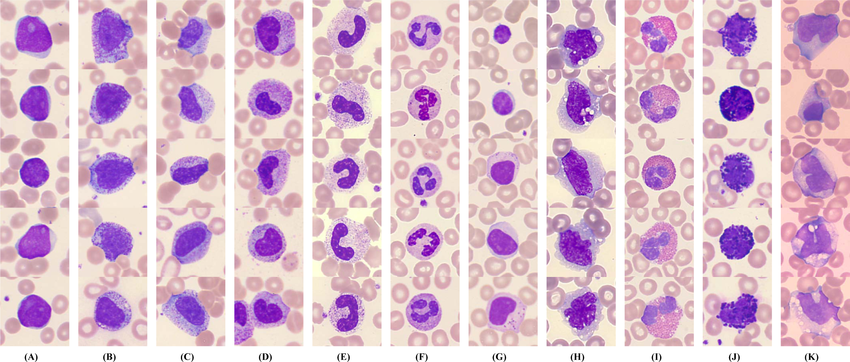 Stained blood smear panels: blast, promyelocyte, myelocyte, metamyelocyte, band, segmented neutrophil, lymphocyte, monocyte