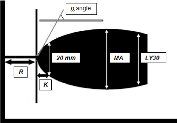 Diagram of a normal thromboelastography trace labelled R time, K time, alpha angle, MA and LY30