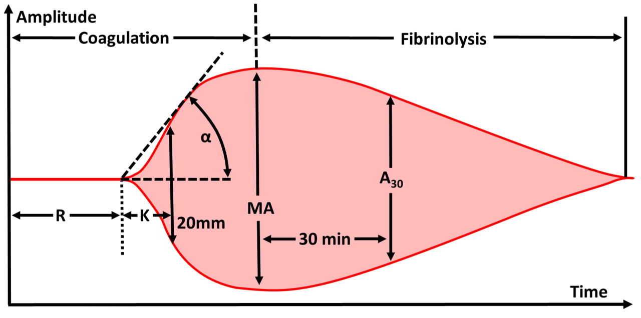Annotated viscoelastic trace marking R, K, alpha angle, maximum amplitude and amplitude at 30 minutes