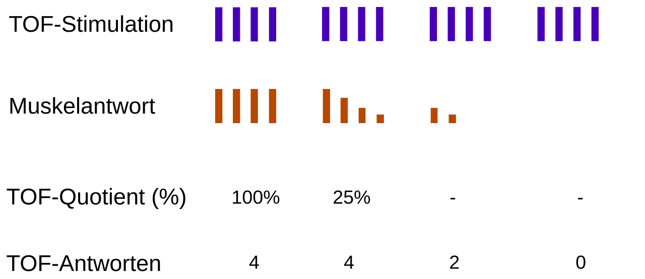 Train-of-four diagram: four twitches at 100%, fading to a 25% ratio, then 2 or 0 twitches as block deepens
