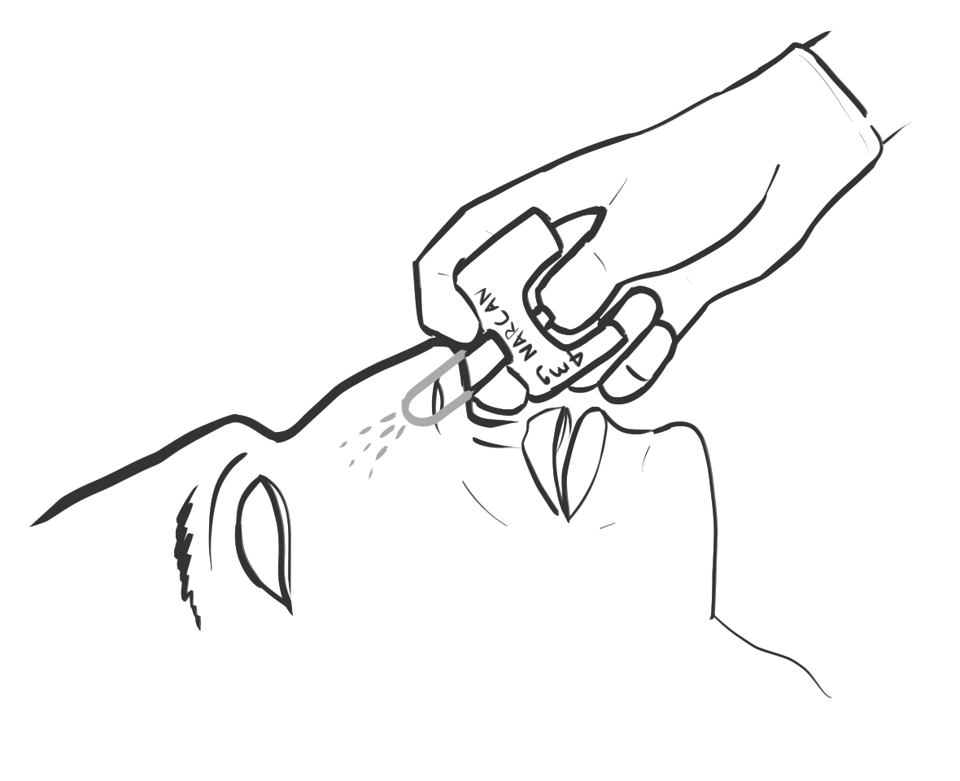 Line drawing of a rescuer pressing a nasal spray device into the nostril of a supine patient with the head tilted back