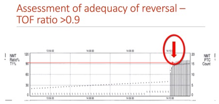 Electromyography train-of-four printout after rocuronium: responses rise above the 90% line after reversal with sugammadex (arrow)