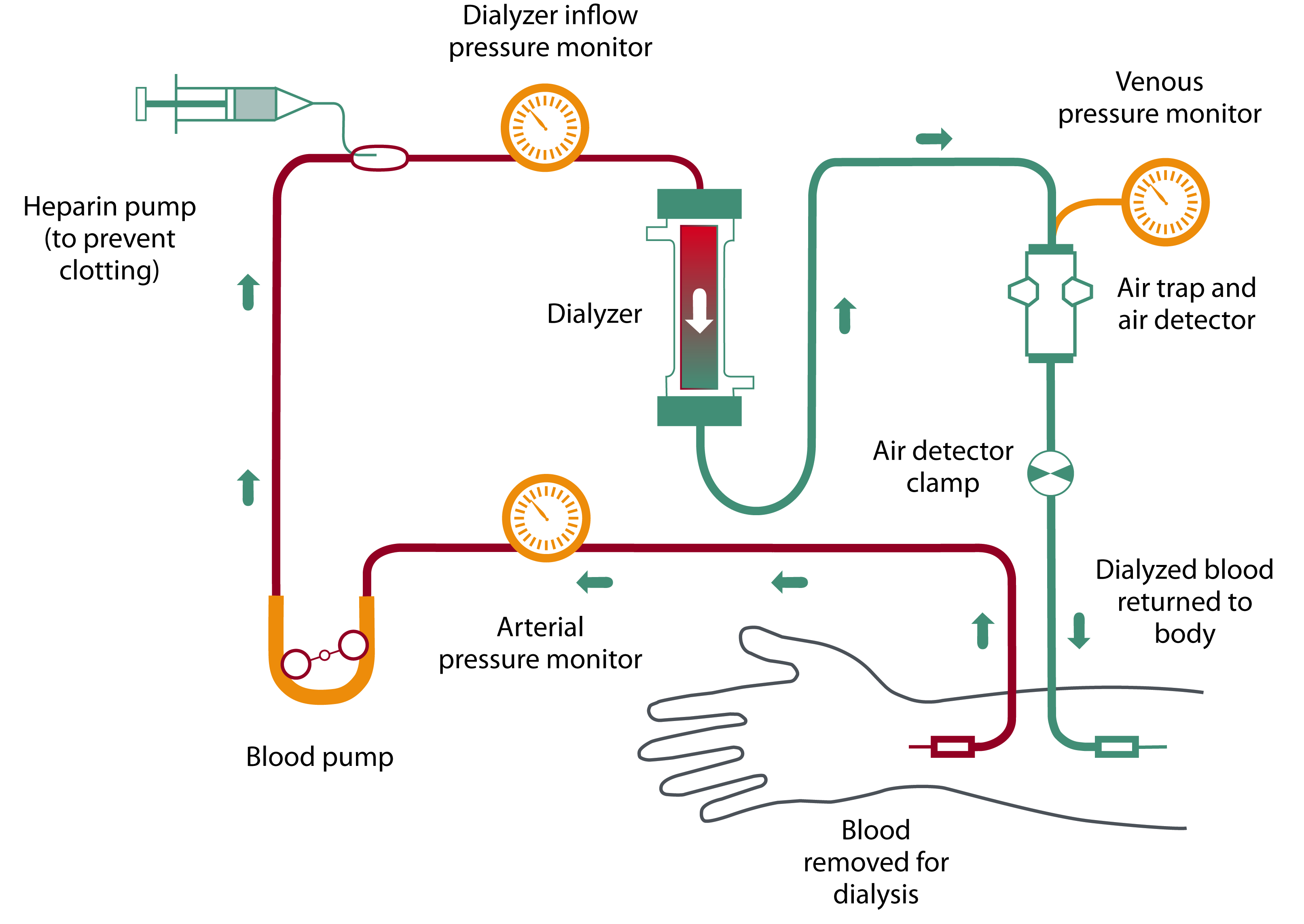 Hemodialysis circuit schematic showing vascular access, blood pump, dialyzer, dialysate flow, air trap, and return line