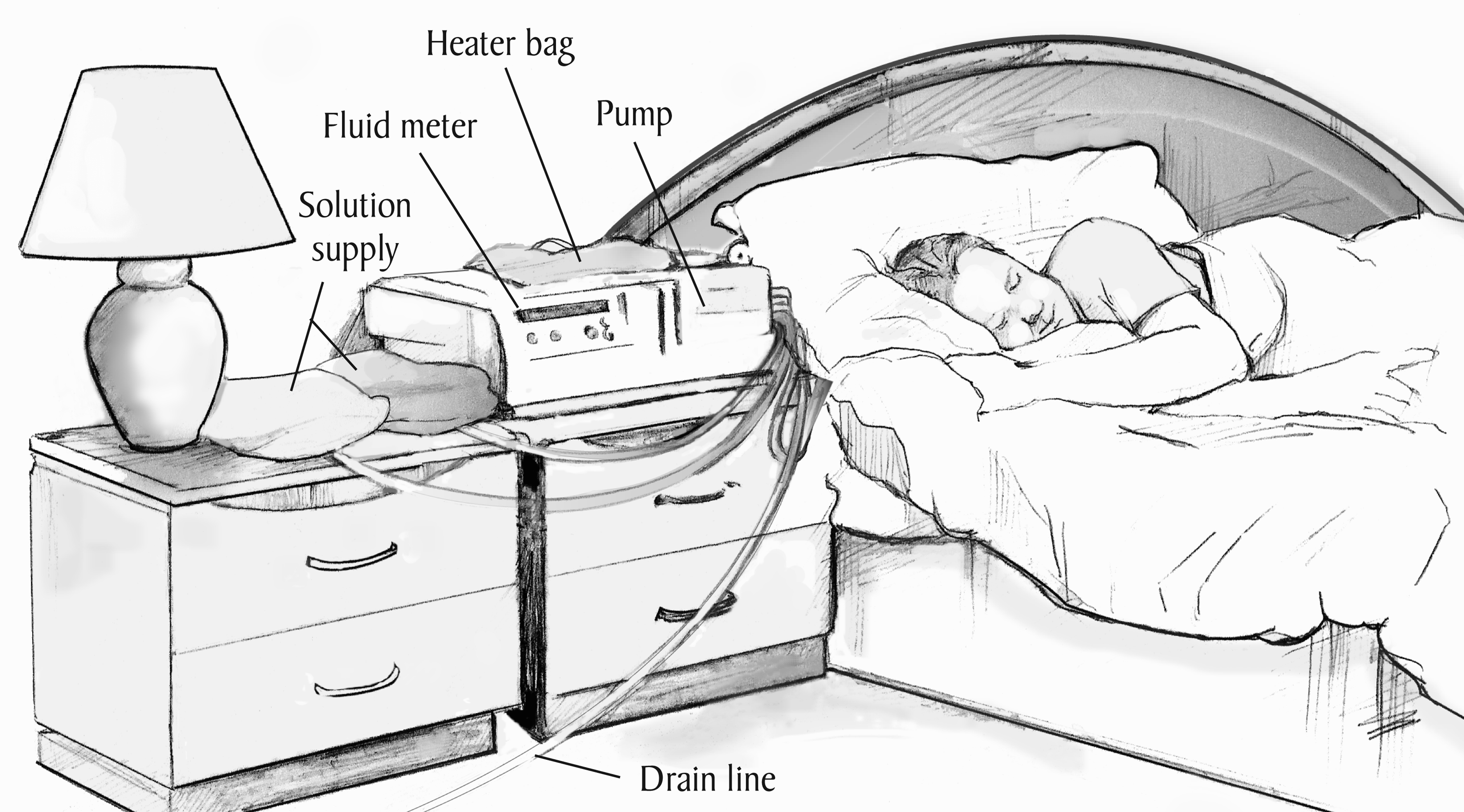 Automated peritoneal dialysis cycler with patient connected at bedside