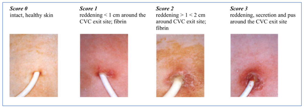 Exit site care procedure and assessment guide